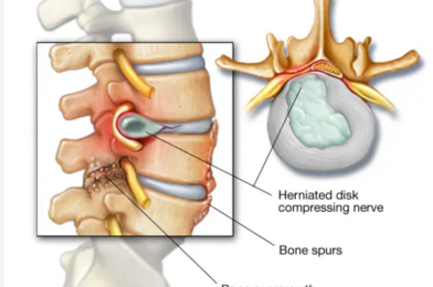 Shocking News From Ortho Doc – BionicOldGuy